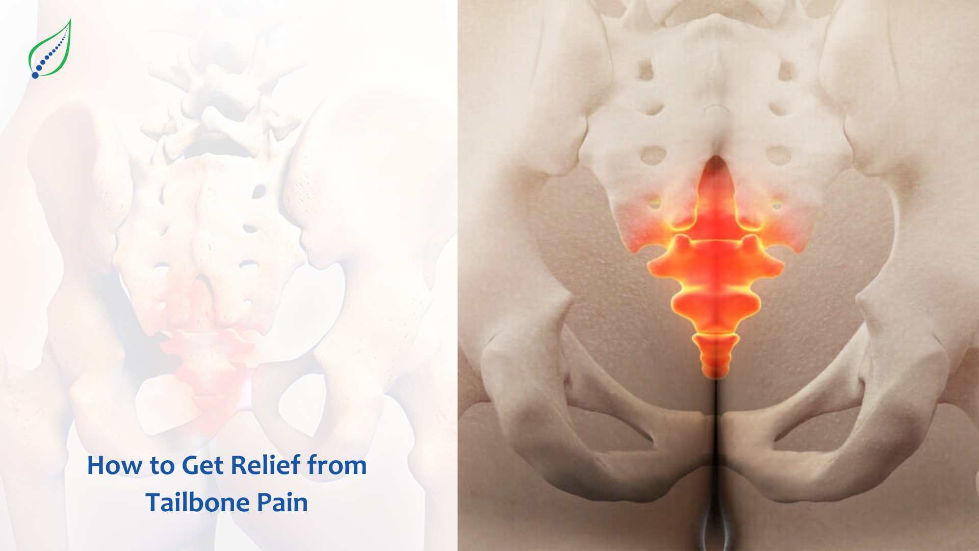 How to Get Relief from Tailbone Pain